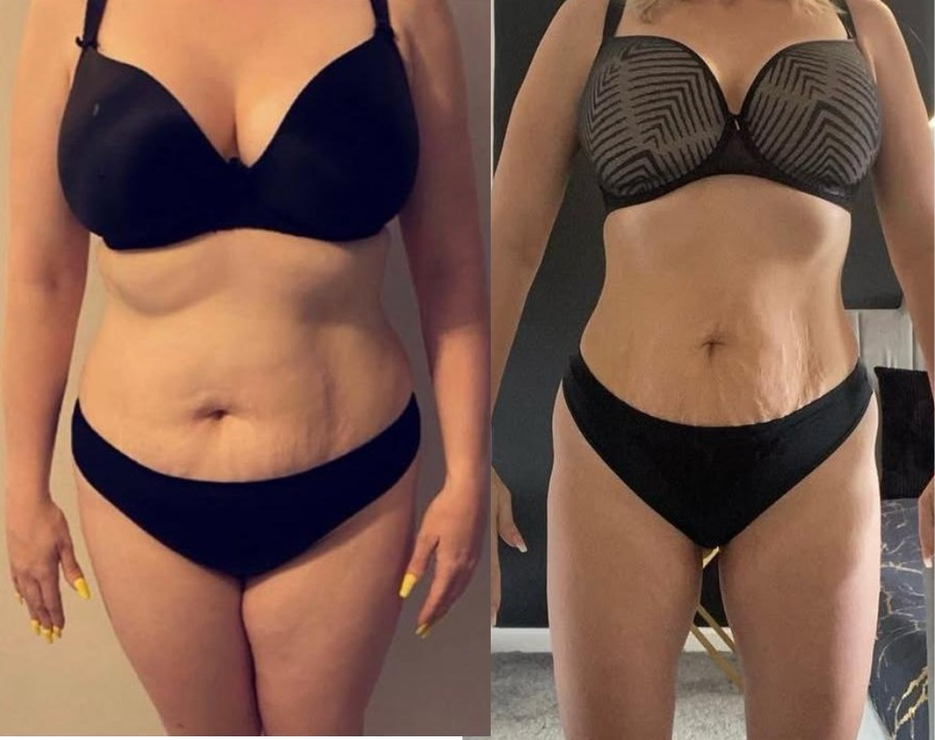 Transformation